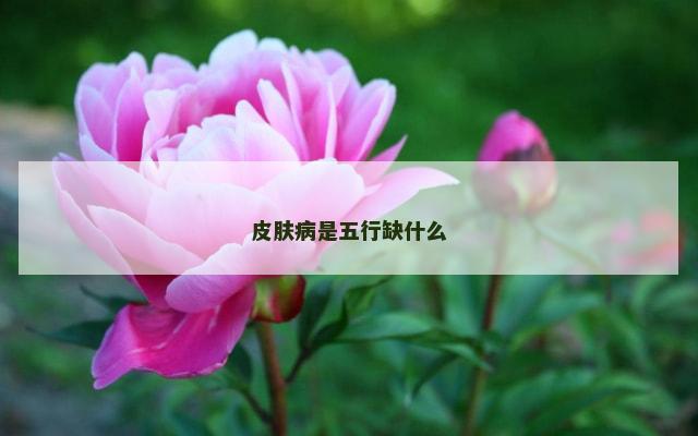 皮肤病是五行缺什么